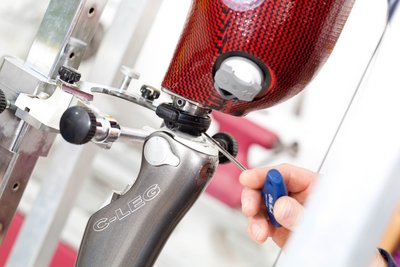 Prothesentechnik Detailaufnahme Nürnberg